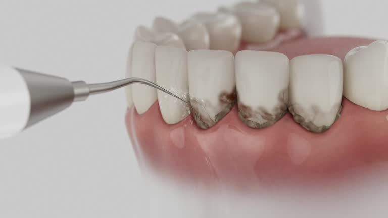 Reliable Teeth Cleaning And Checkup contractor in Mercer County County, MO by Dentist Open Now